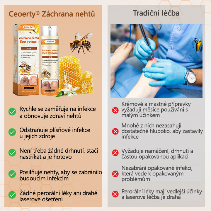 【Oficiální vlajkový obchod】Ceoerty® NailRescue Včelí jed ve spreji